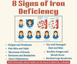 8 signs of iron deficiency including fatigue, pale skin, dry hair, dizziness, mouth sores and restless legs syndrome